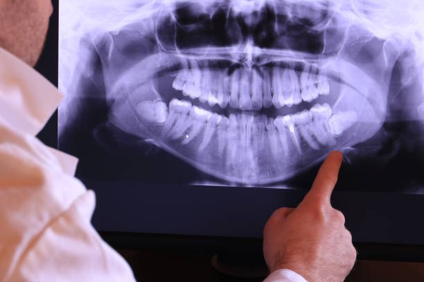 Best Emergency Treatment for Oral Infections in Pleasant Hill, IA